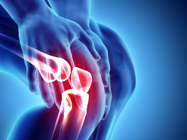 Viscosupplementation - Bowen Hefley Orthopedics
