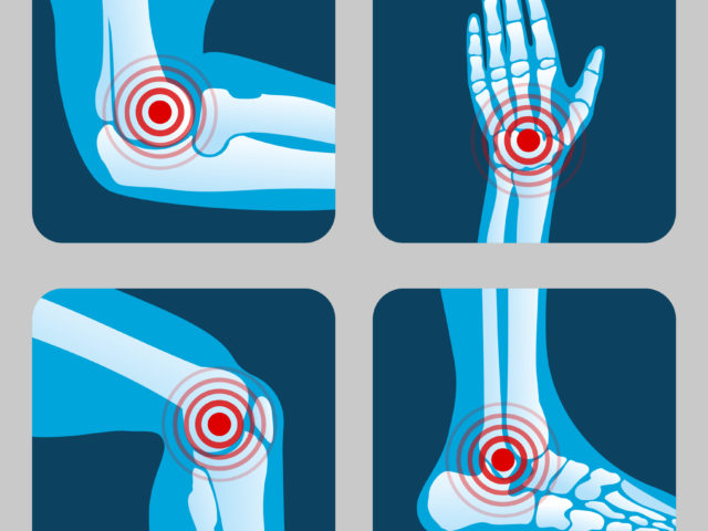 Arthritis pain
