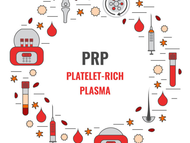 prp therapy - prp treatment