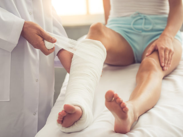 orthopedic doctor putting cast on woman's leg