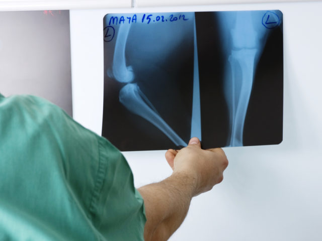 orthopedic surgeon looking at x-rays