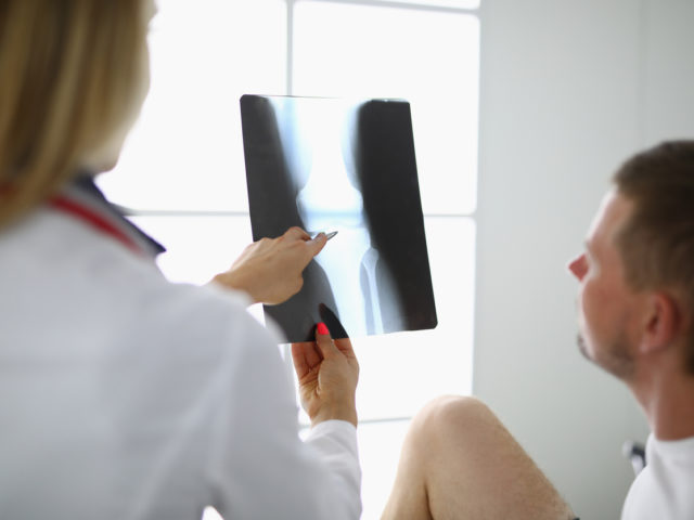 Orthopedic doctor showing a patient's knee xray