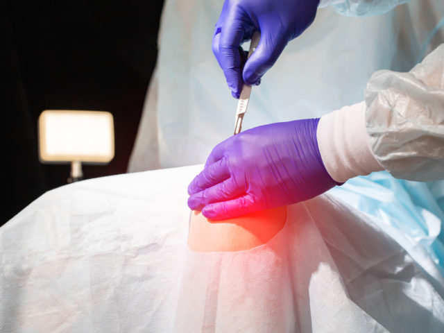 Doctor operation Total Knee replacement surgery