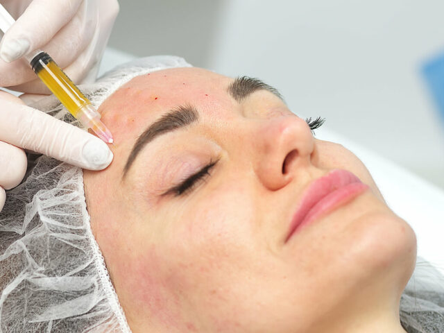 A doctor performs PRP therapy by injecting plasma into a young woman's face.