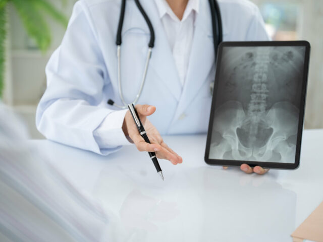 An orthopedic surgeon explain spine lumber vertebrae x-ray image on digital tablet to the patient.