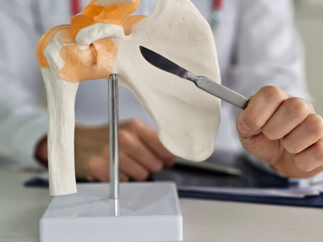 Image showing Shoulder surgery and arthroscopic shoulder surgery concept.