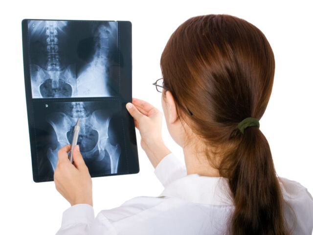 Female orthopedic surgeon examining an x-ray.